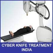 Expert CyberKnife doctors in India
